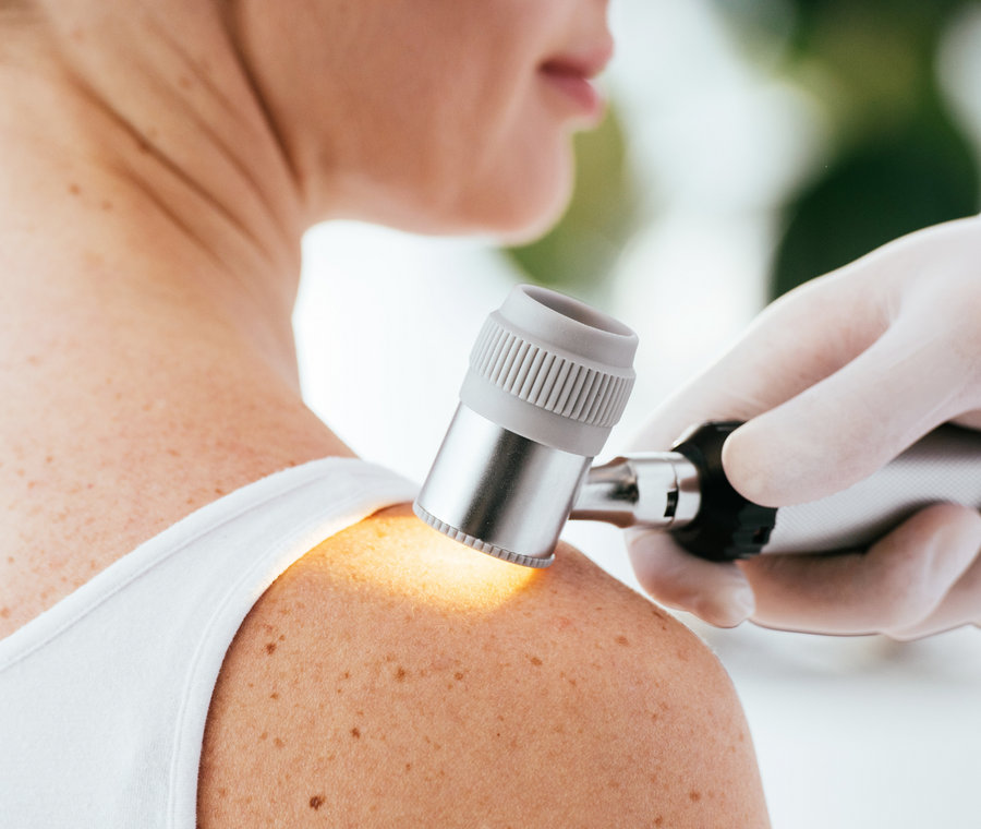 Dermatology skin examination at Life Coast Health